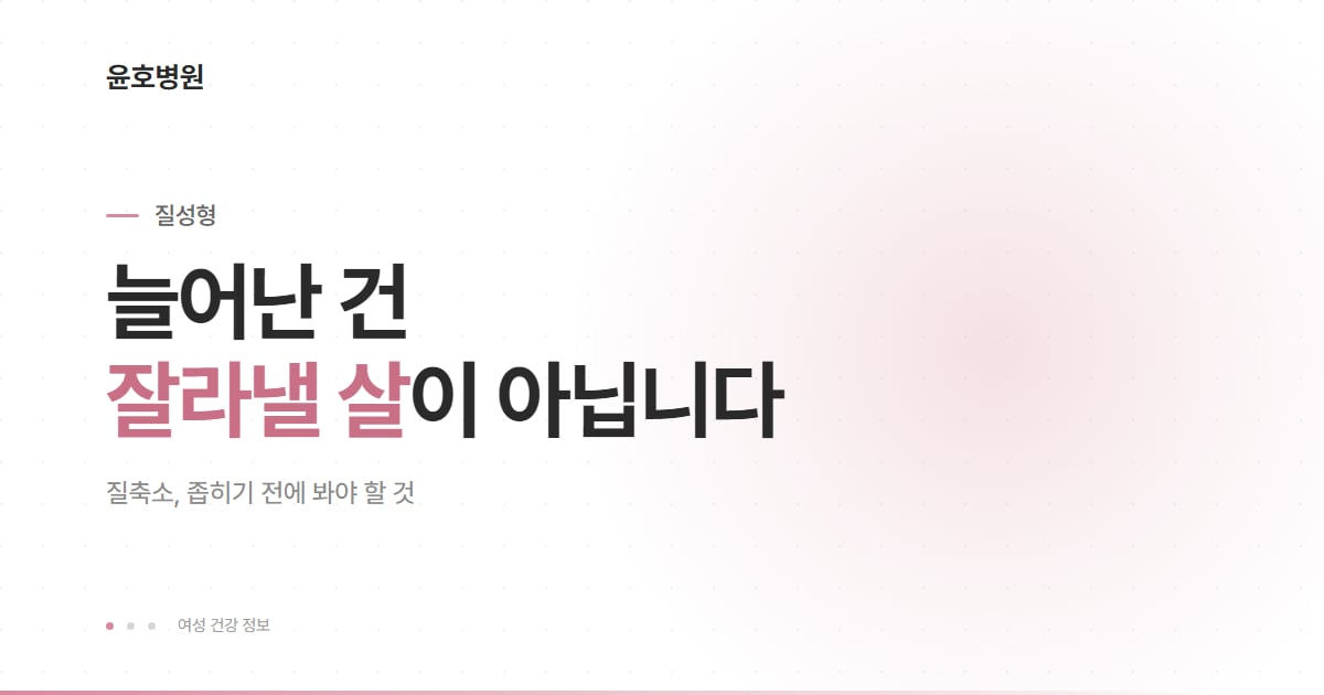 질축소를 지지구조 관점에서 바라본 대표 이미지