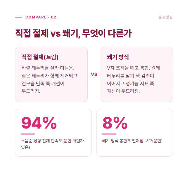 직접 절제와 쐐기 방식의 차이 비교 도표