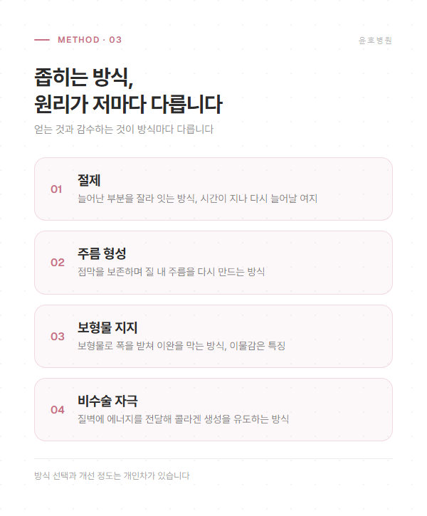 절제, 주름 형성, 보형물 지지, 비수술 자극이라는 네 갈래 방식의 원리를 정리한 도해